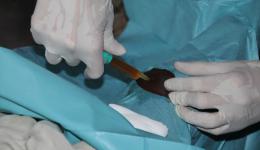 Nach dem Abpunktieren der Flüssigkeit am nächsten Tag ...