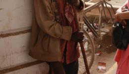 Später am Connaught Place stoßen wir auf einen Mann mit Stock und schmerzverzerrtem Gesicht und einer großen schräg verlaufenden Fleischwunde am rechten Bein unterhalb des Knies. Ohne zu betteln geht er an uns vorbei. Später am Connaught Place stoßen wir auf einen Mann mit Stock und schmerzverzerrtem Gesicht und einer großen schräg verlaufenden Fleischwunde am rechten Bein unterhalb des Knies. Ohne zu betteln geht er an uns vorbei.