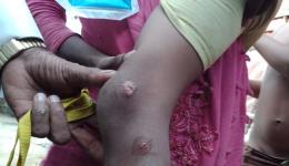 Small wounds that can have serious consequences without treatment due to the lack of hygiene.